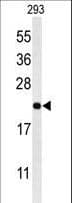 MRAP Antibody (aa7-36)