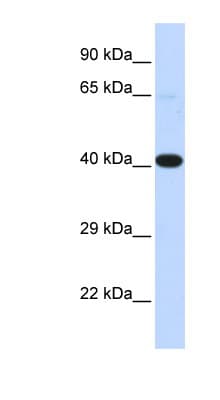 HSF2BP Antibody (aa72-121)
