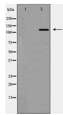 Polyclonal Rabbit anti-Human TYK2 Antibody (WB)