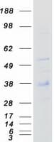 Human CD79B / CD79 Beta Protein (Recombinant Myc-DDK (Flag))