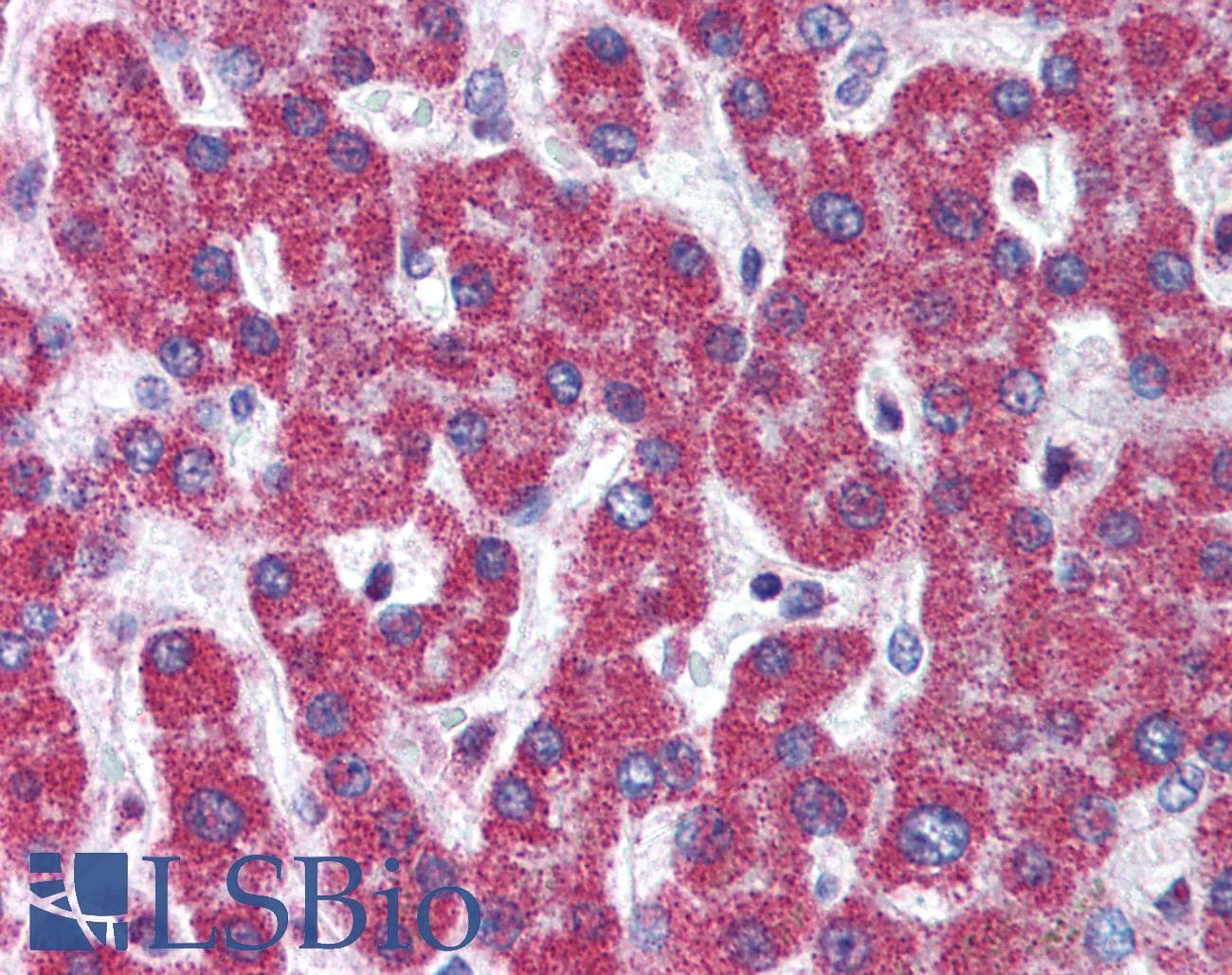 IHC-plus™ Polyclonal Rabbit anti-Human Apg7 / ATG7 Antibody (IHC, IF, WB)