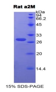 Rat A2M / Alpha-2-Macroglobulin Protein (Recombinant His)