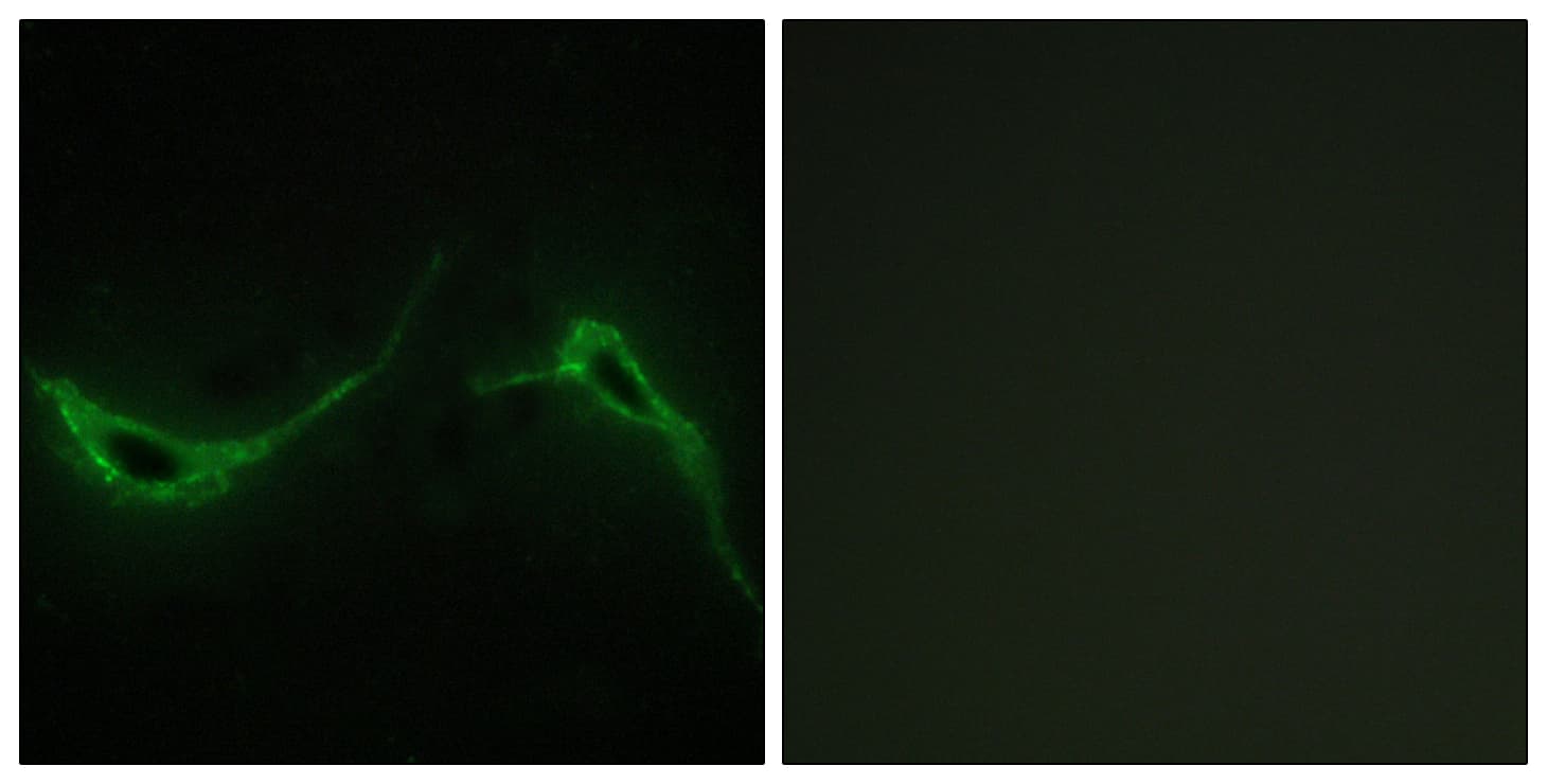Polyclonal Rabbit anti-Human ADCY7 / Adenylate Cyclase 7 Antibody (aa191-240, IHC, IF)