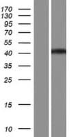 RCCD1 Protein (Over-Expression Lysate Myc-DDK (Flag))
