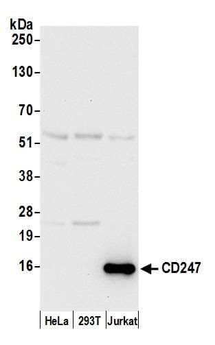 Polyclonal Rabbit anti-Human CD247 / CD3 Zeta Antibody (aa114-164, WB)
