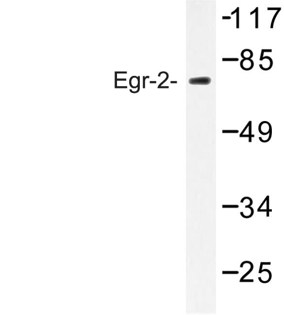 EGR1 + EGR2 Antibody (Arg409)