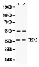 TREX2 Antibody