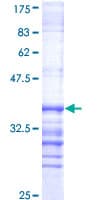 Human DYRK / DYRK1A Protein (Recombinant GST, N-terminus)