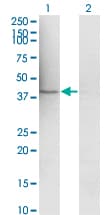 MAP2K1 / MKK1 / MEK1 Antibody (clone 1B5)