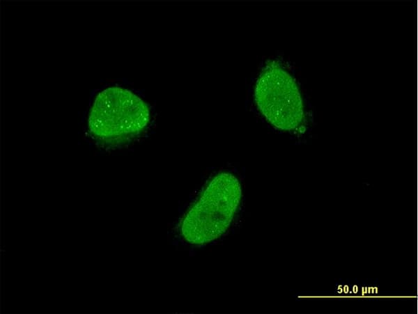 ZNF7 Antibody (clone 6F2)