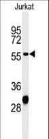 HADHB Antibody (aa315-342)