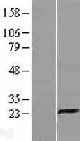 KLRD1 / CD94 Protein (Over-Expression Lysate Myc-DDK (Flag))