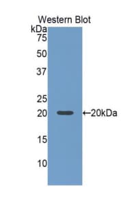 SLIT2 Antibody (aa1160-1333, Biotin)
