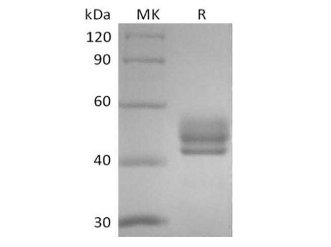 Human CD3E + CD3D Protein (Recombinant Fc/6His,C-terminus)