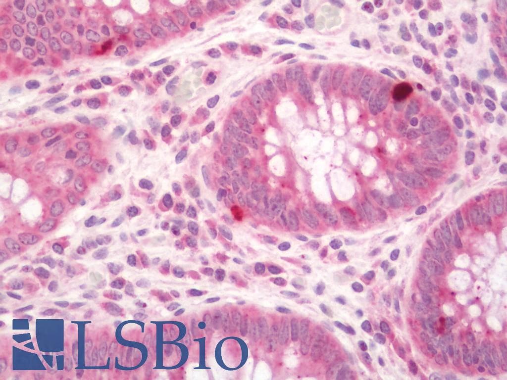 CASP8 / Caspase 8 Antibody (HRP)