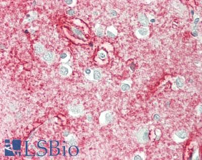 IHC-plus™ Polyclonal Rabbit anti-Human AQP4 / Aquaporin 4 Antibody (IHC, WB)