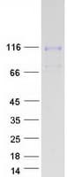 Human NEP / DDR1 Protein (Recombinant Myc-DDK (Flag))
