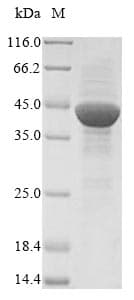 Pig ANPEP / CD13 Protein (Recombinant 10His, N-terminus + Myc, C-terminus)