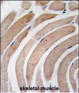 ATG4D Antibody (aa 326-356)