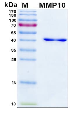 Mouse MMP10 Protein (Recombinant 6His, N-terminus)