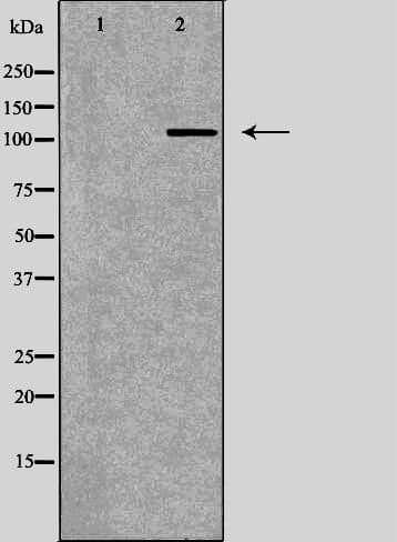 Polyclonal Rabbit anti-Human ATP2A2 / SERCA2 Antibody (IHC, WB)