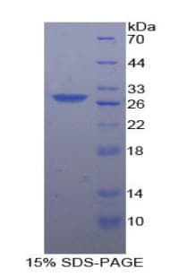Human CSNK1A1 / CK1 Alpha Protein (Recombinant His-T7)