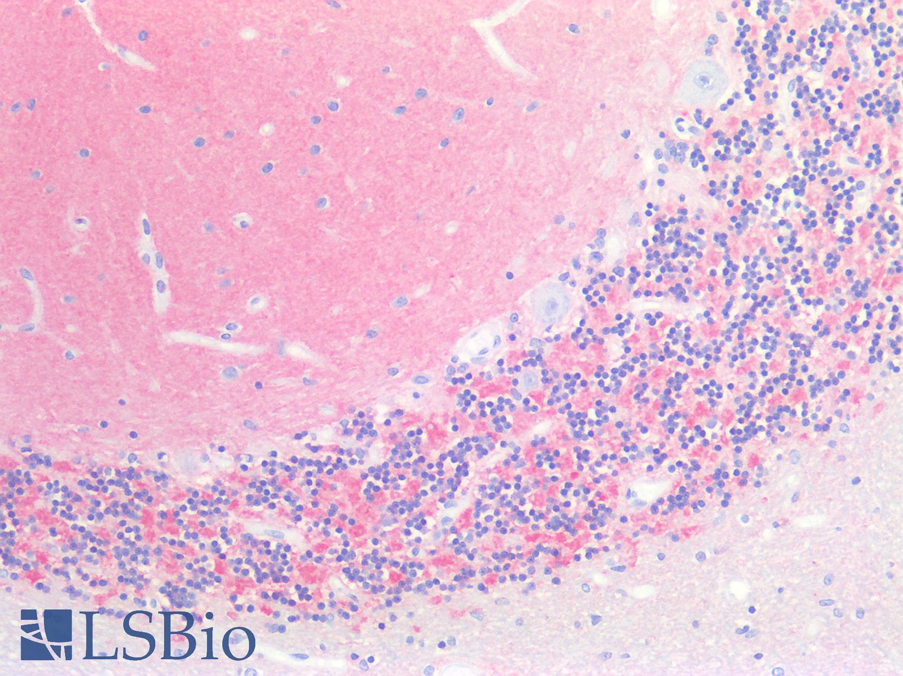 IHC-plus™ NCAM / CD56 Antibody
