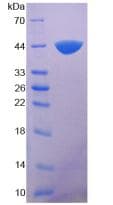 Human Complement C7 Protein (Recombinant His-T7)