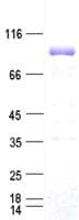 Human FOXP1 Protein (Recombinant DDK,C-terminus)