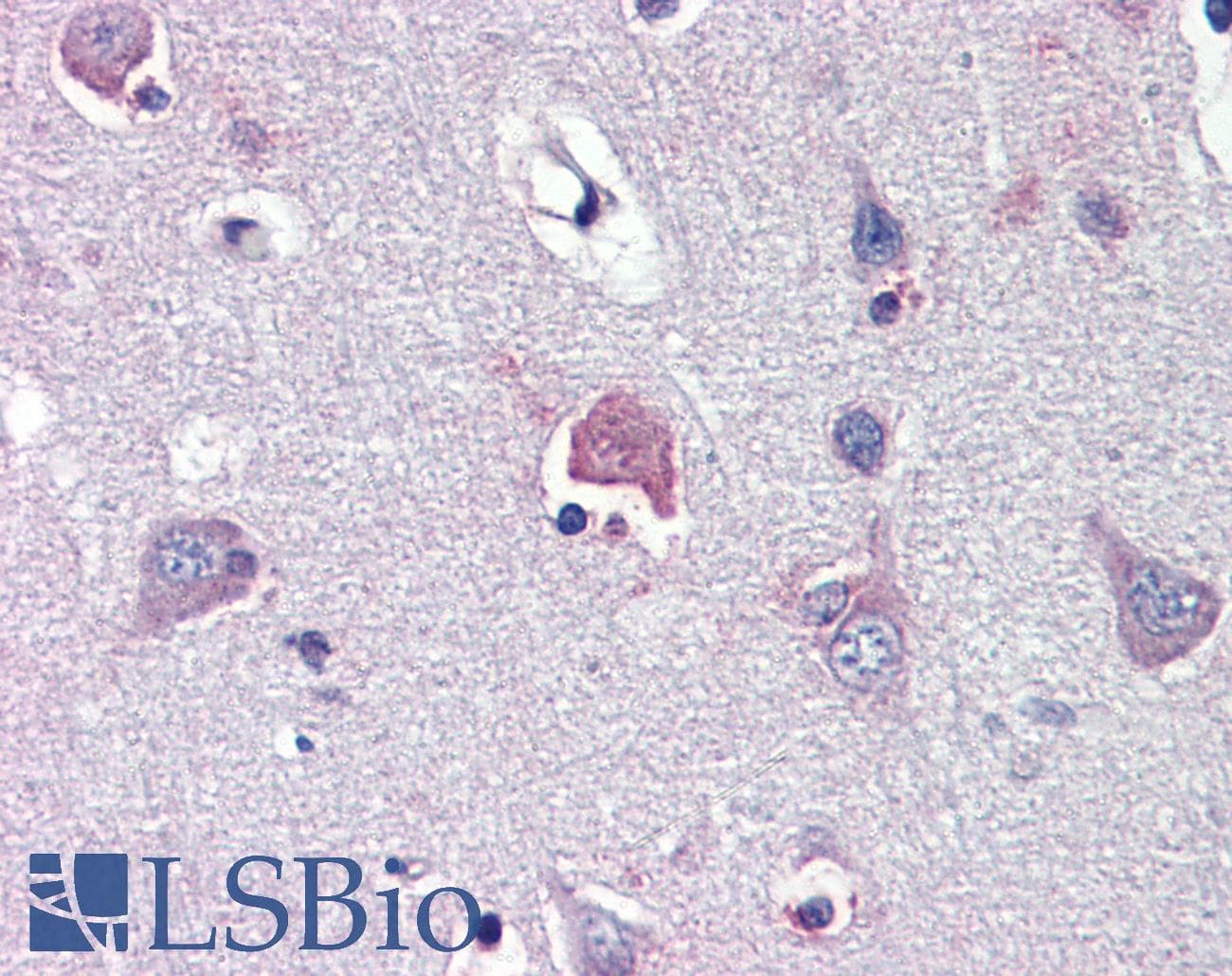 LDOC1 Antibody (N-Terminus)