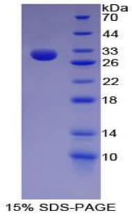 Mouse HAT1 Protein (Recombinant His-T7)