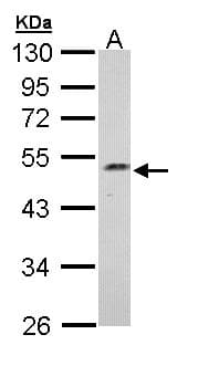 C17orf75 Antibody (aa1-215)