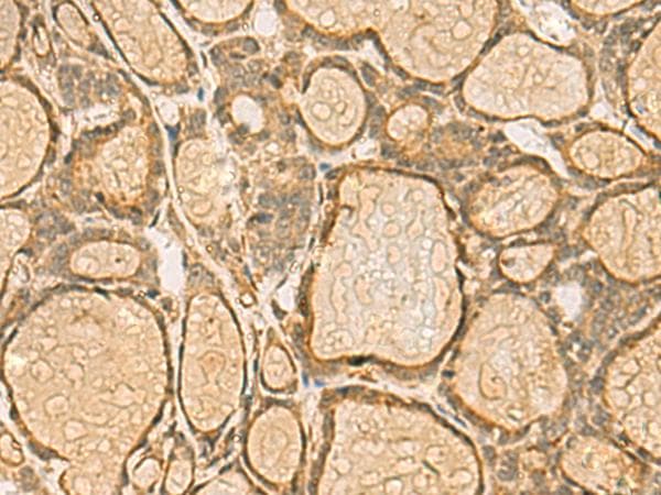HORMAD2 Antibody