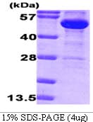 E. coli G6PD Protein (Recombinant)