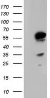 TCP11L2 Antibody (clone OTI1H7)