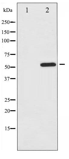 ATF2 Antibody (phospho-Ser112/94)