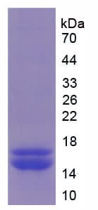 Human FURIN Protein (Recombinant His)