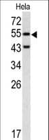 CASP8 / Caspase 8 Antibody (aa432-461)