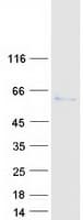 Human KAT5 / TIP60 Protein (Recombinant Myc-DDK (Flag))