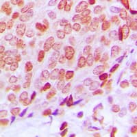 IHC-plus™ XRCC6 / Ku70 Antibody (N-Terminus)
