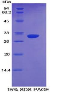 Mouse CYP1A1 Protein (Recombinant His-T7)