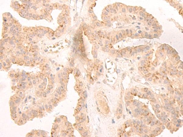LCMT2 / YW4 Antibody