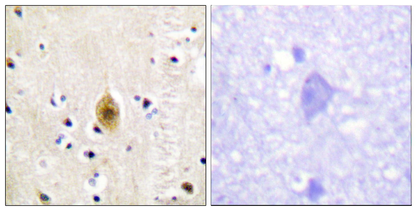 MST1 + MST2 Antibody (phospho-Thr183)