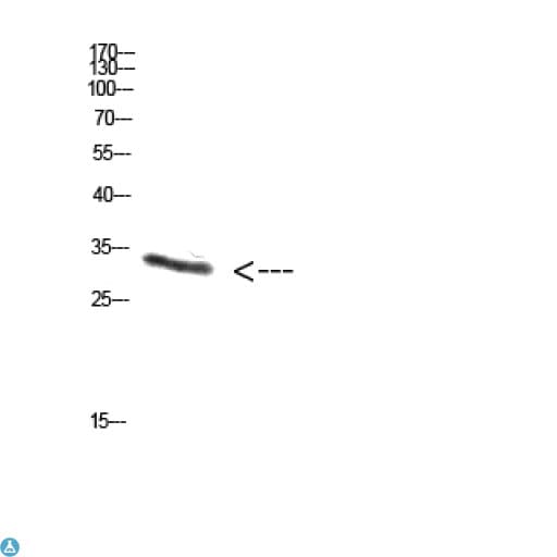 Polyclonal Rabbit anti-Human Proenkephalin / PENK Antibody (WB)