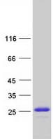 Human HMGN1 / HMG14 Protein (Recombinant Myc-DDK (Flag))