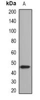 Polyclonal Rabbit anti-Human LIPA / Lysosomal Acid Lipase Antibody (WB)
