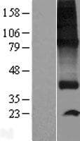SPNS1 / Spinster Protein (Over-Expression Lysate Myc-DDK (Flag))