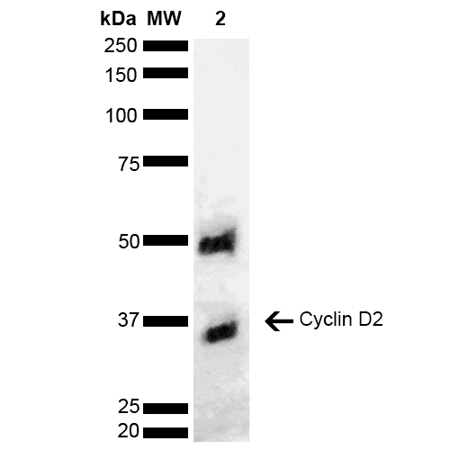 CCND2 / Cyclin D2 Antibody (Biotin)