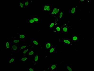 HIST1H1D Antibody