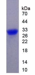 Mouse CCND1 / Cyclin D1 Protein (Recombinant His)